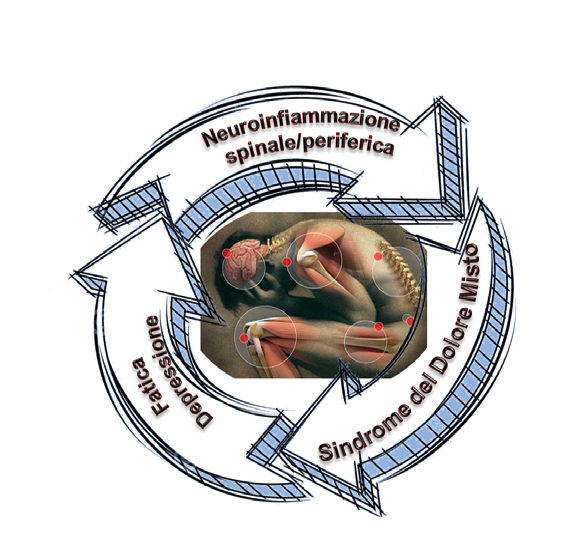 Flow-Chart sulla Fibromialgia